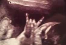 Bebê faz o devil horn e aparece em ultrassom