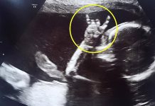 Bebê ultrassom chifrinho rock porraaaaaa