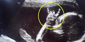 Bebê ultrassom chifrinho rock porraaaaaa