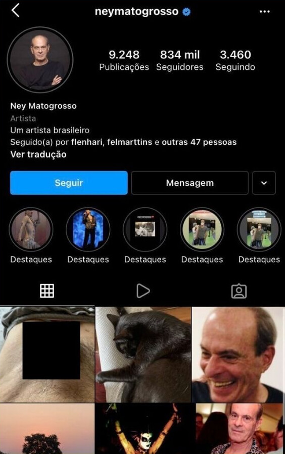 Ney Matogrosso posta foto do pênis por acidente