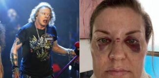 Axl Rose machuca fã com microfone em show do Guns N' Roses