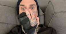 Travis Barker (blink-182) passará por cirurgia na mão